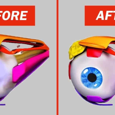 10 Great Exercises to Improve Your Eyesight